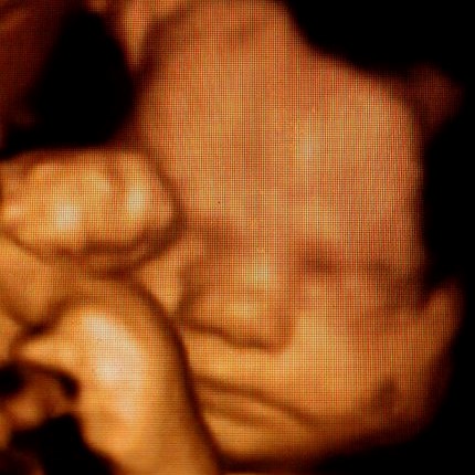 ultrasound during pregnancy